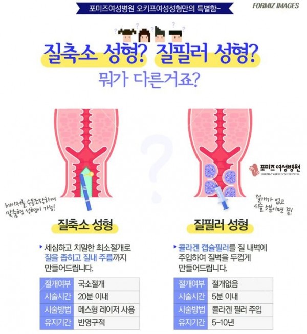 요즘 2~30대 여자가 많이 받는 시술 - 꾸르