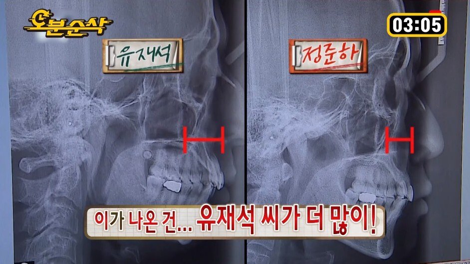 정준하가 유재석 가둬 놓고 패던 특집 - 짤티비