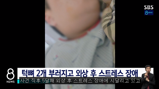 중학생 턱뼈 부러뜨린 태권도 관장…내놓은 해명 - 짤티비