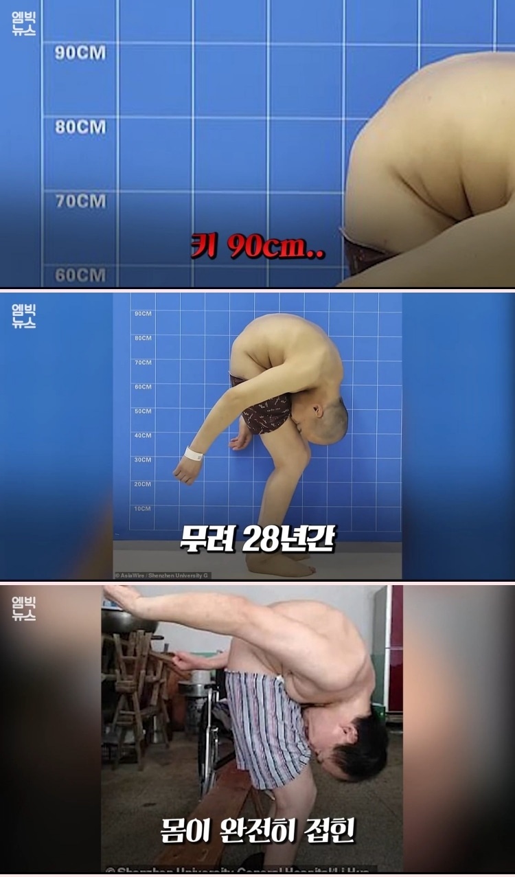 접힌 남자에게 찾아온 기적