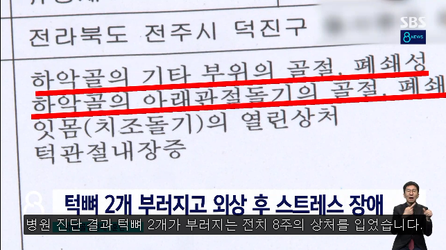 중학생 턱뼈 부러뜨린 태권도 관장…내놓은 해명 - 짤티비