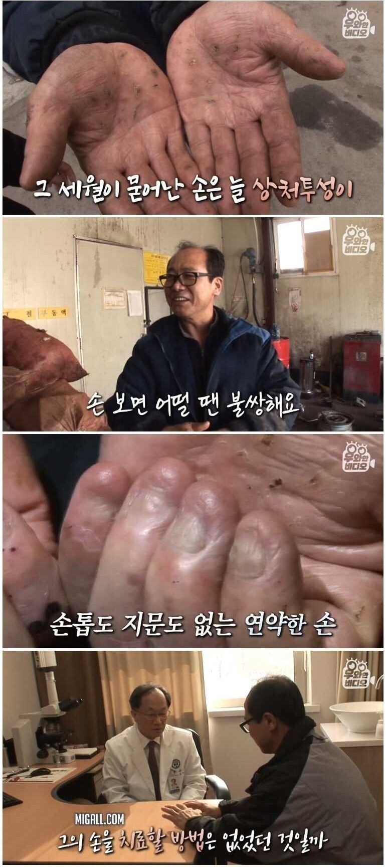 손톱 발톱이 없는 남자 - 꾸르