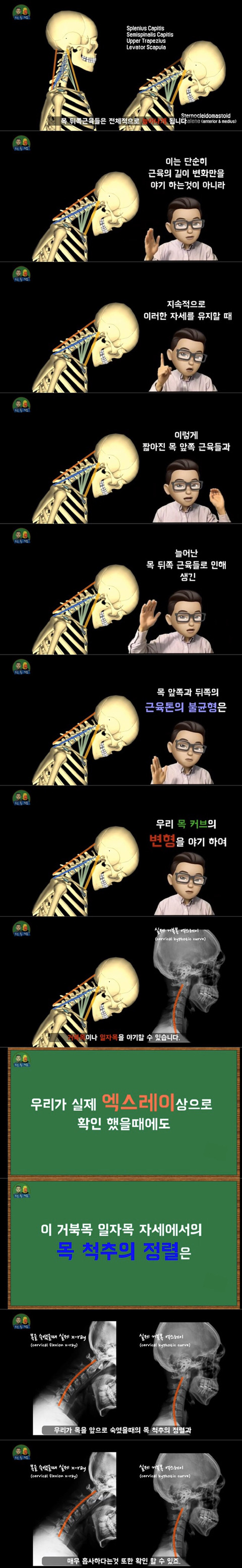 공부할때 고개를 숙이고 하면 안되는 이유. 통증 유발 이유