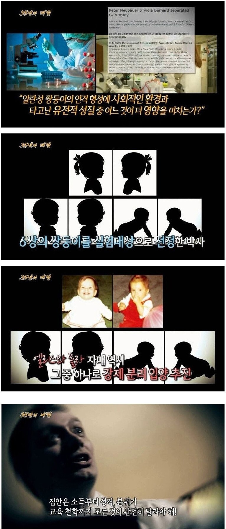 35년 동안 실험 대상이 된 쌍둥이 자매 - 짤티비