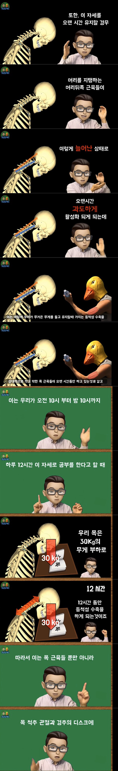 공부할때 고개를 숙이고 하면 안되는 이유. 통증 유발 이유