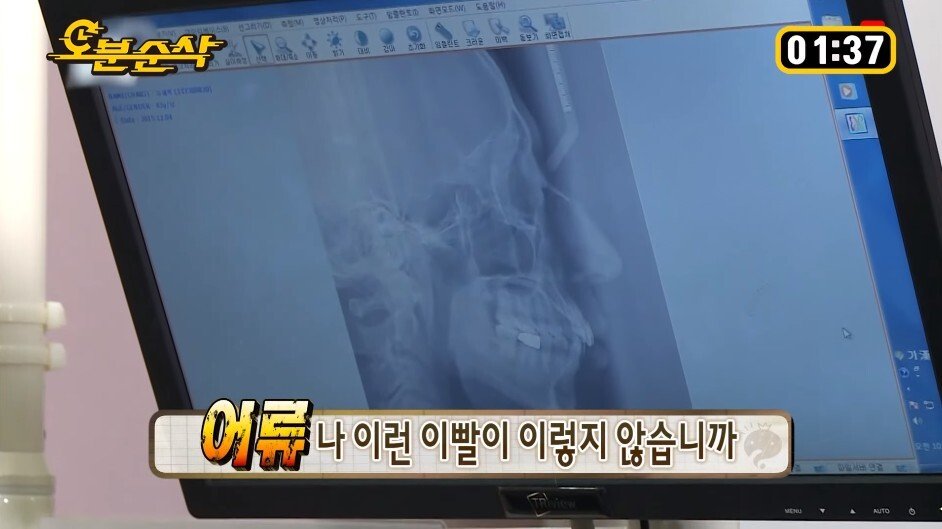 정준하가 유재석 가둬 놓고 패던 특집 - 짤티비