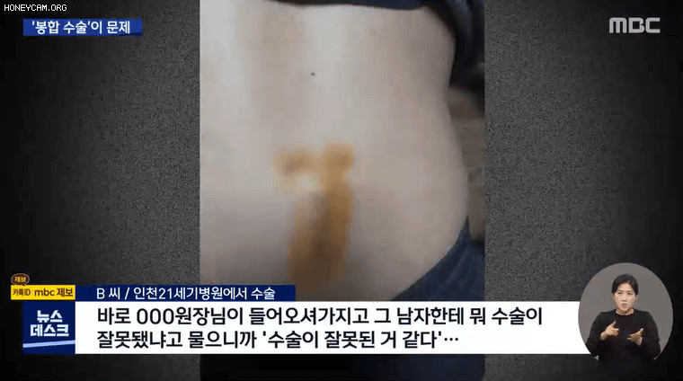 대리수술 병원 전직 간호사의 폭로 - 짤티비