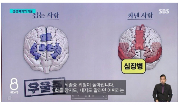 image.png 화 참는 사람 뇌 VS 화낸 사람 뇌 비교  jpg